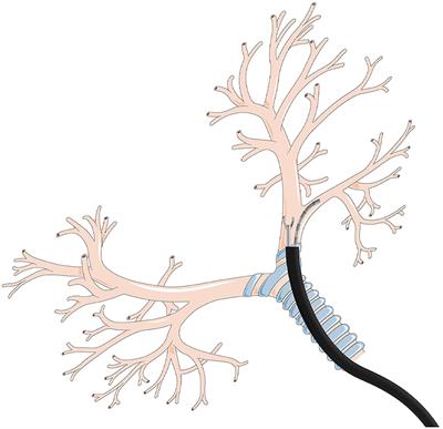 Adaptive fuzzy control for tendon-sheath actuated bending-tip system with unknown friction for robotic flexible endoscope